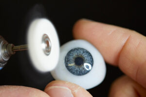 FAQ's What is a bespoke ocular prosthetic?